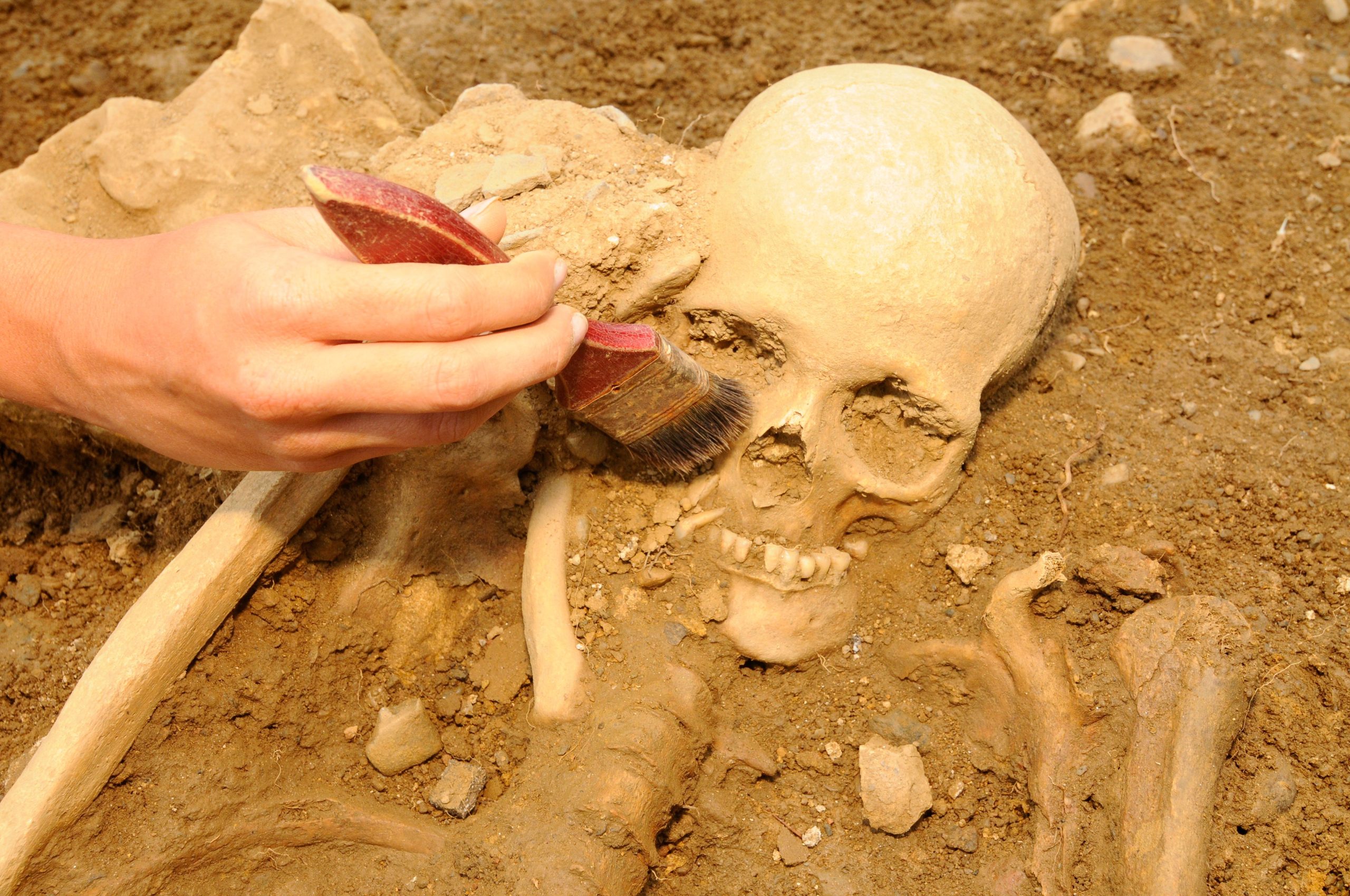 Mittelalterliches Skelett vergießt Licht auf die Schwedens Gesundheitsversorgung für Behinderte