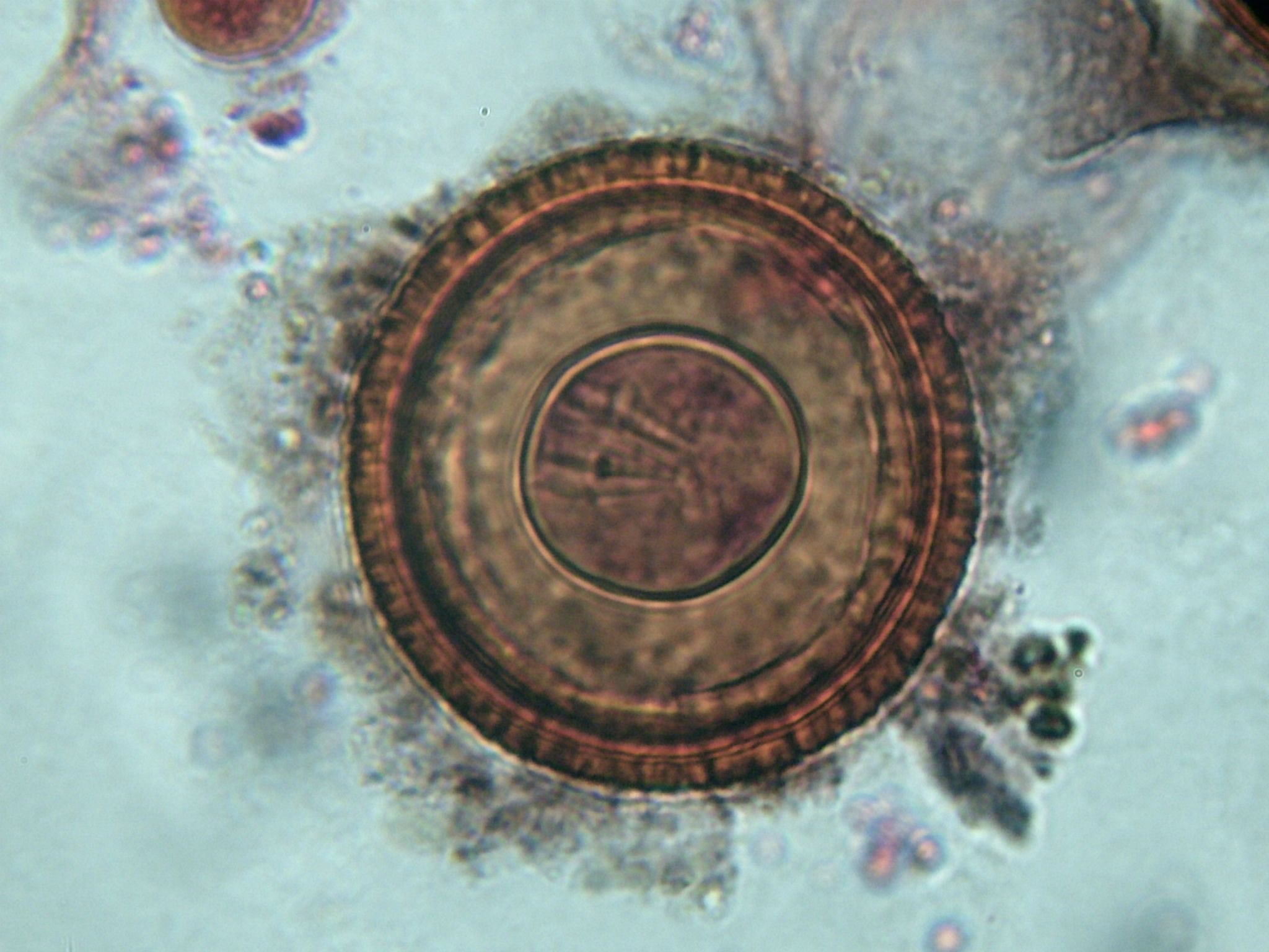 Würmer können in Ihrem Gehirn leben, ohne dass Sie es wissen (und hier ist, wie Sie es verhindern können)